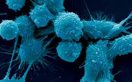 Рак предстательной железы