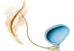 Эффективный метод лечения рецидивного недержания мочи     у женщин