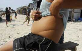 Удаление почки повышает шансы эректильной дисфункции