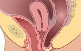 Что нового в лечении пролапса тазовых органов?