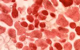 Микоплазмоз в два раза увеличивает риск на приобретение ВИЧ-инфекции