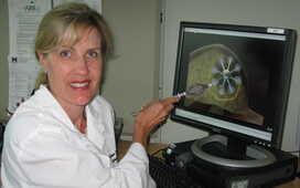 Лучевая и гормональная терапия РПЖ – влияние на выживаемость