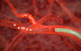 Новый метод хирургического лечения аденомы простаты     и недержание мочи