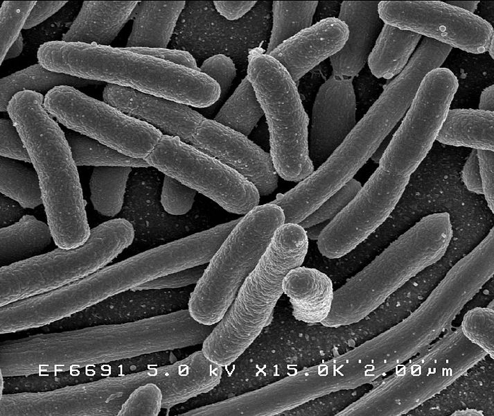 «Маленькие враги». Бактериальный цистит – что/кто его вызывает?