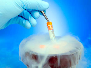 Замораживание тканей яичка поможет сохранить фертильность